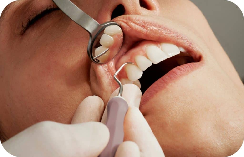 Dental examination with mirror and scaler during a dental checkup.
