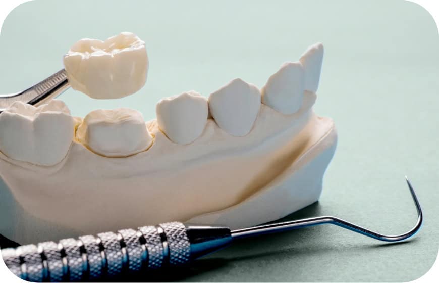 Dental model with a dental scaler and a dental crown on a light green background.