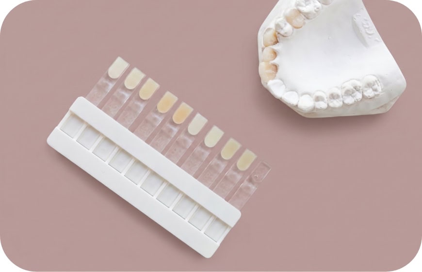 Dental shade guide and model of teeth for color matching at Enamelle Dental.